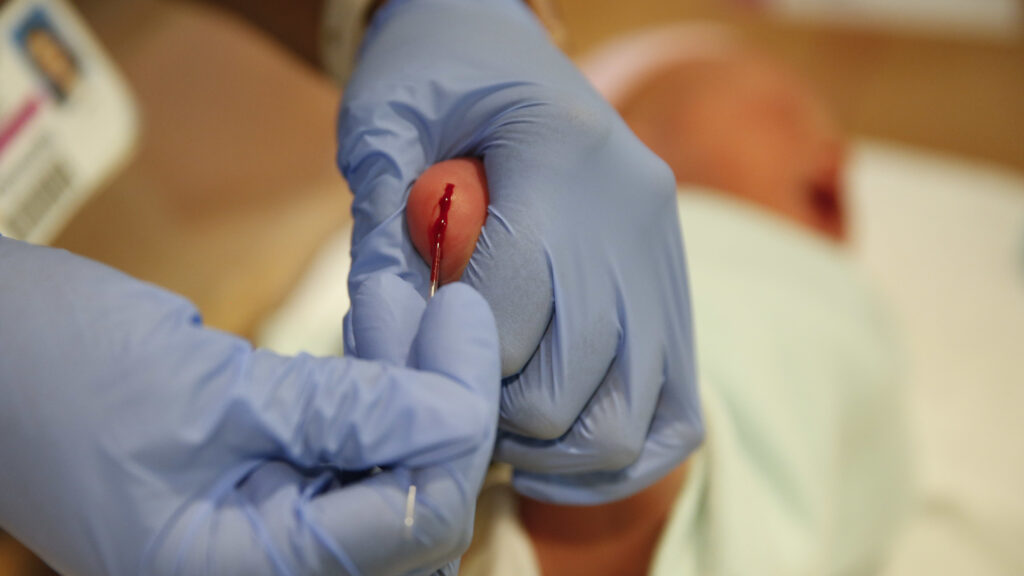 The committee in charge of newborn screening has been terminated | STAT