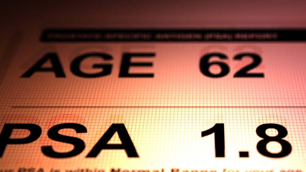 What PSA test reliance gets wrong about prostate cancer treatment | STAT