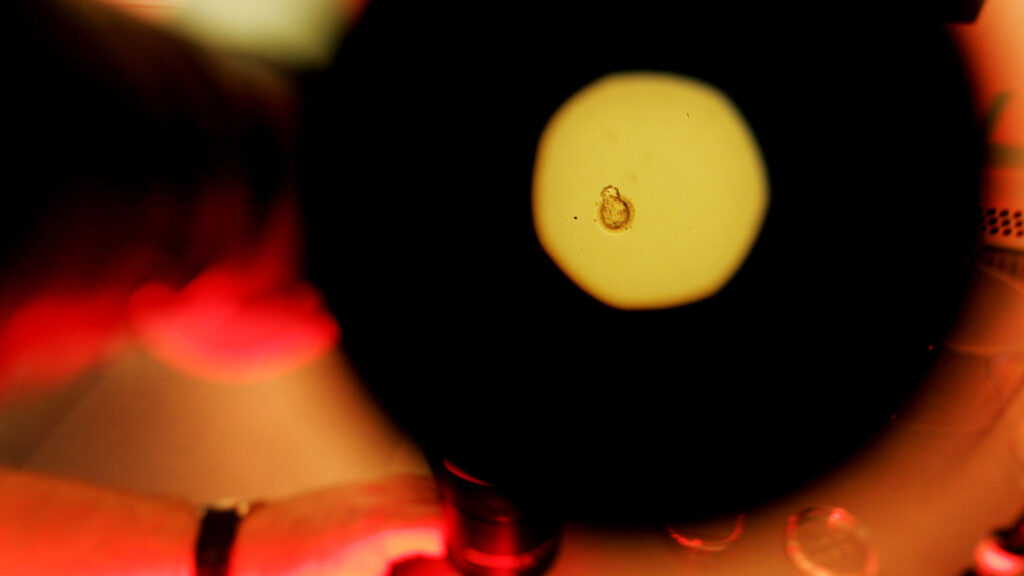 Next frontier in reproductive technology demands tough conversations | STAT