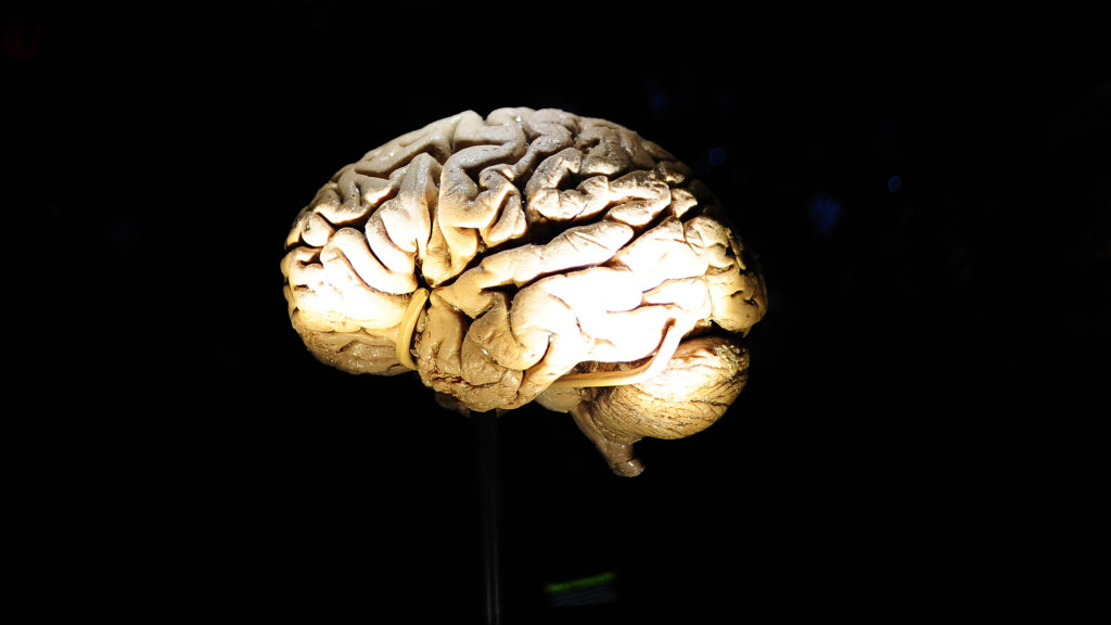An NFL widow and scientist examines an NFLPA-funded CTE study | STAT