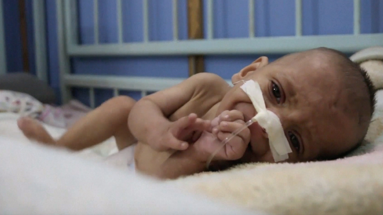Babies are dying of starvation in this besieged Syrian city